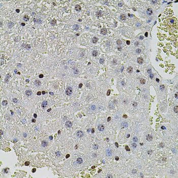 SET / TAF-I Antibody