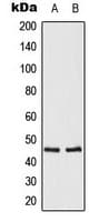OPRM1 / Mu Opioid Receptor Antibody (C-Terminus)