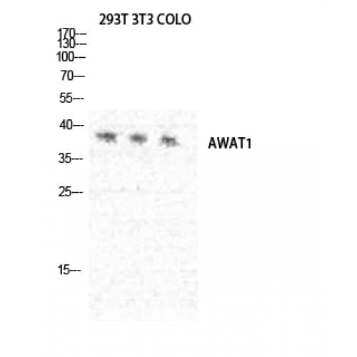 Polyclonal Rabbit anti-Human AWAT1 / DGAT2L3 Antibody (230-310 aa, C-terminal, WB)
