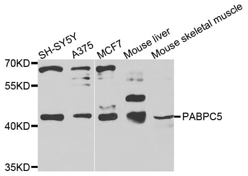 PABPC5 Antibody