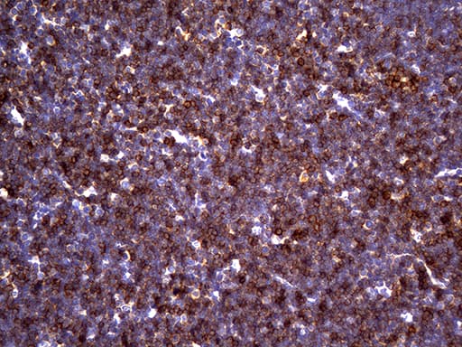 Monoclonal Mouse anti-Human CD5 Antibody (clone UMAB9, IHC, IF, WB)