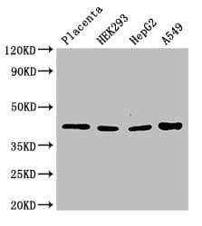 HSD3B1 Antibody