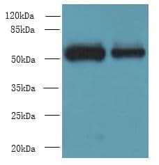 WDR88 Antibody