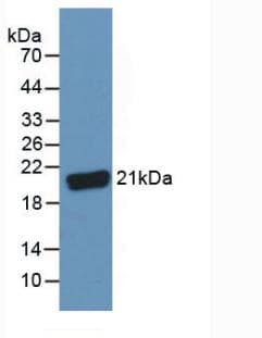 Complement C8g Antibody (aa39-202, APC)