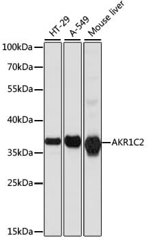 BABP / AKR1C2 Antibody