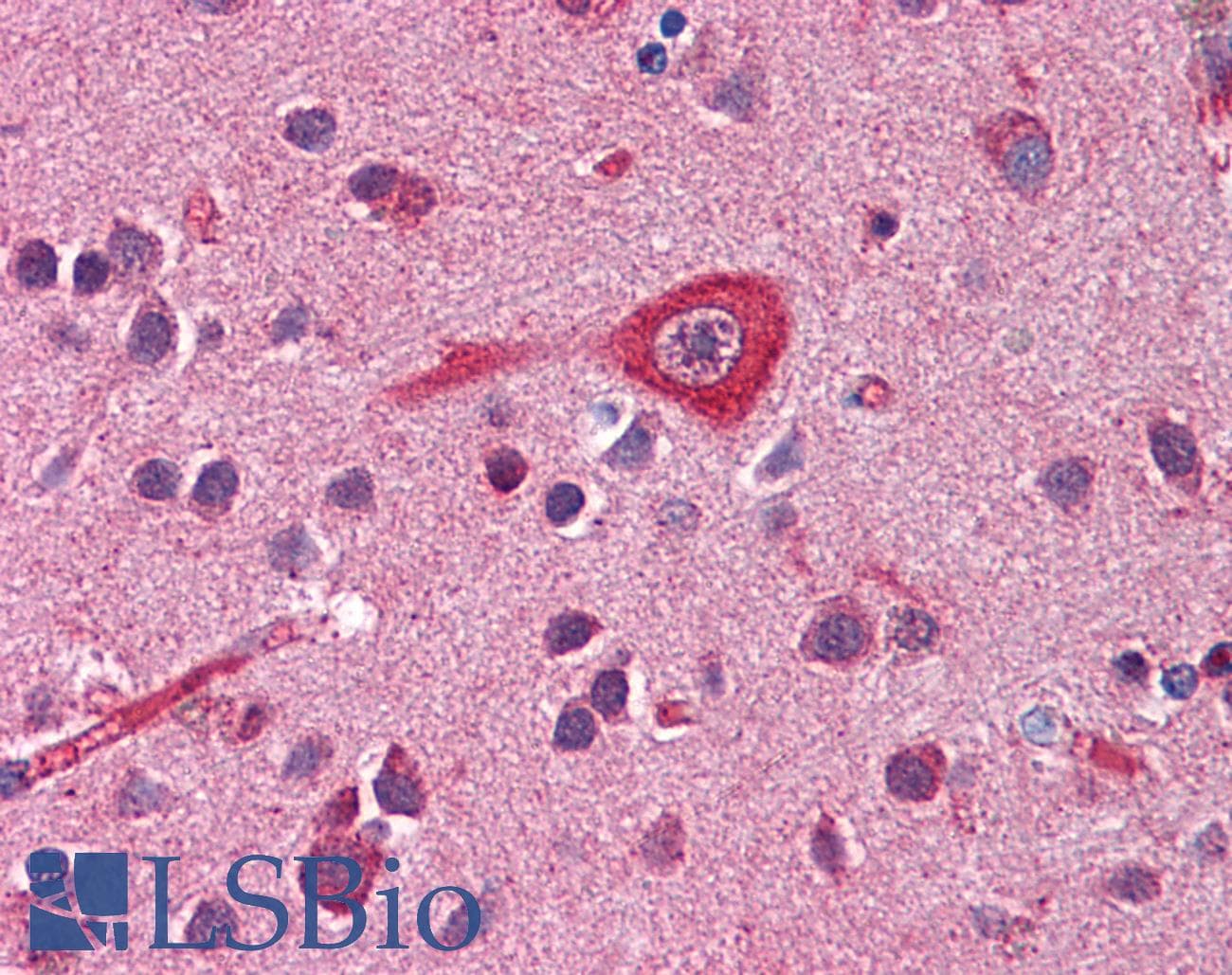 IHC-plus™ APBA2 Antibody