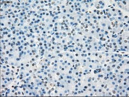 Monoclonal Mouse anti-Human CYPOR / POR Antibody (clone OTI3F10, IHC, IF, WB)