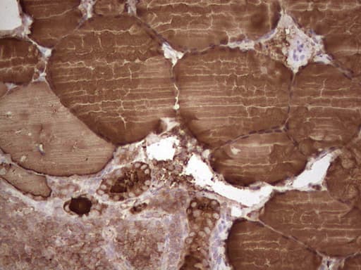 TG / Thyroglobulin Antibody (aa20-358, clone OTI15E11)