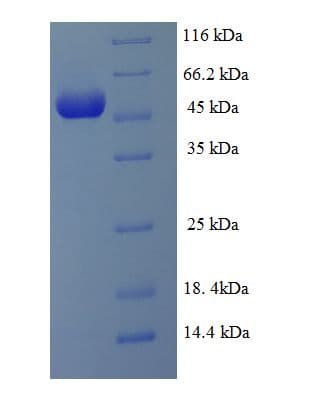 Human SPT3 / SUPT3H Protein (Recombinant His-SUMO)