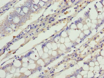 C1orf101 Antibody