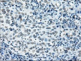 CYPOR / POR Antibody (clone OTI5B3)