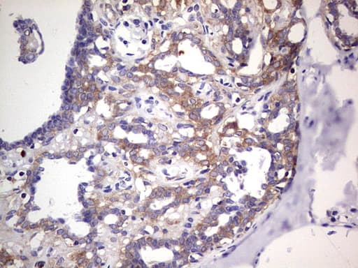 Monoclonal Mouse anti-Human PKM2 Antibody (clone 1F12, IHC, WB)