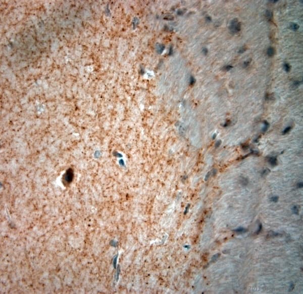 GAD 65+67 Antibody (aa530-600)