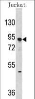 Polyclonal Rabbit anti-Human DNMT3A Antibody (aa457-486, IHC, WB)