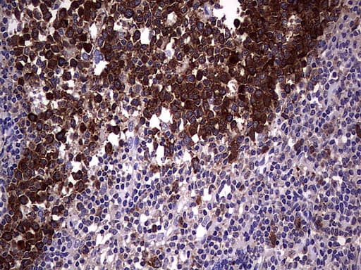 R1 / RRM1 Antibody (aa541-792, clone UMAB165, Carrier-free)