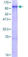 Human AKAP10 Protein (Recombinant GST)