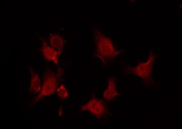 Polyclonal Rabbit anti-Human YWHAZ / 14-3-3 Zeta Antibody (IF, WB)