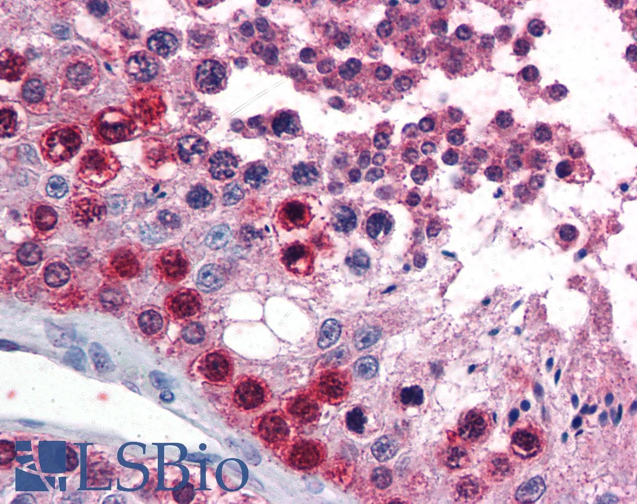 IHC-plus™ ATF7 Antibody (aa482-494)