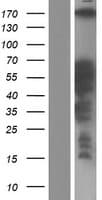 CCDC88C Protein (Over-Expression Lysate Myc-DDK (Flag))