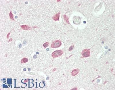 IHC-plus™ Polyclonal Rabbit anti-Human CA9 / Carbonic Anhydrase IX Antibody (Internal, IHC, WB)