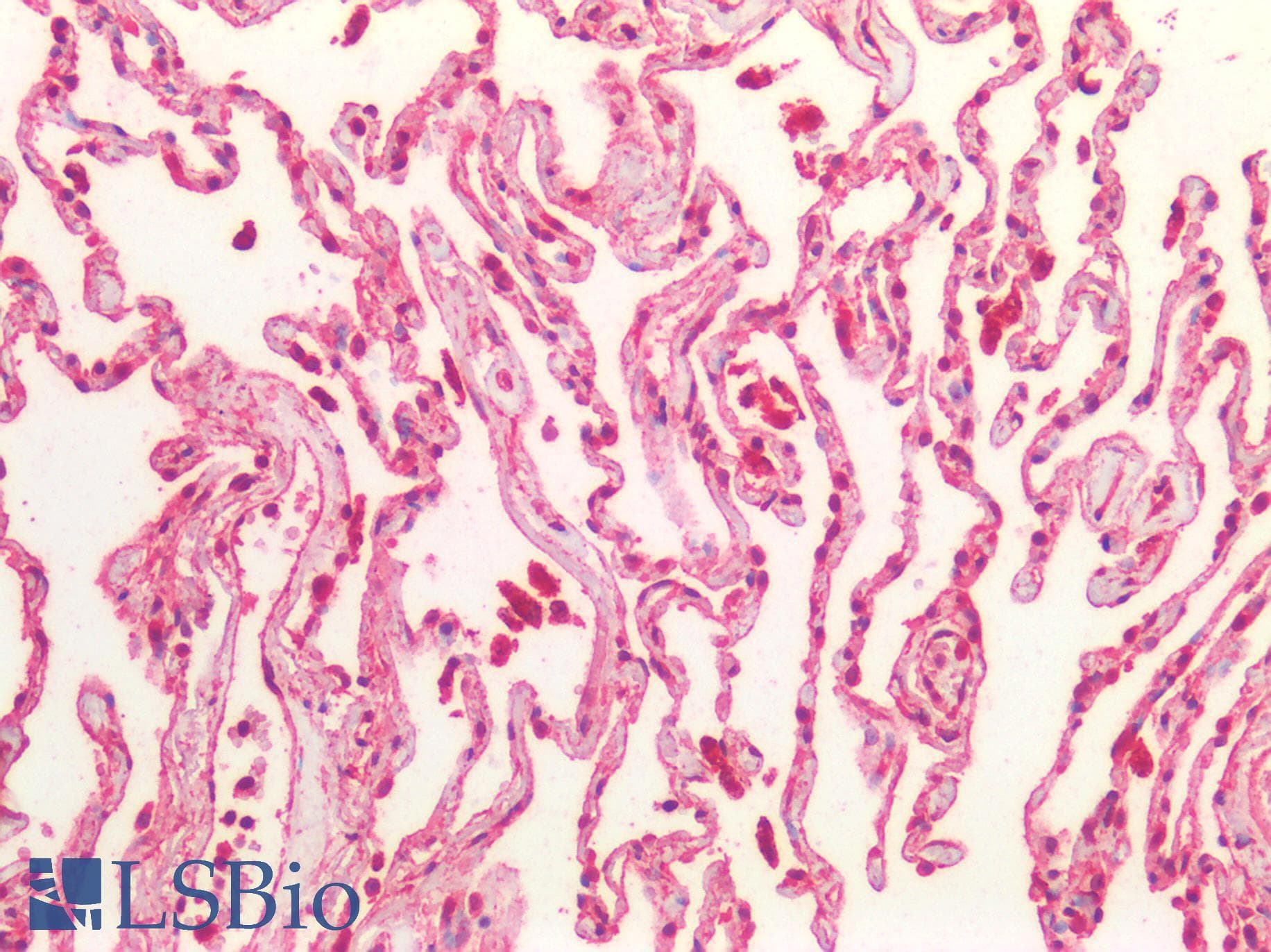 PathPlus™ BCL10 / BCL-10 Antibody (aa5-19)