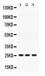 AK2 / Adenylate Kinase 2 Antibody