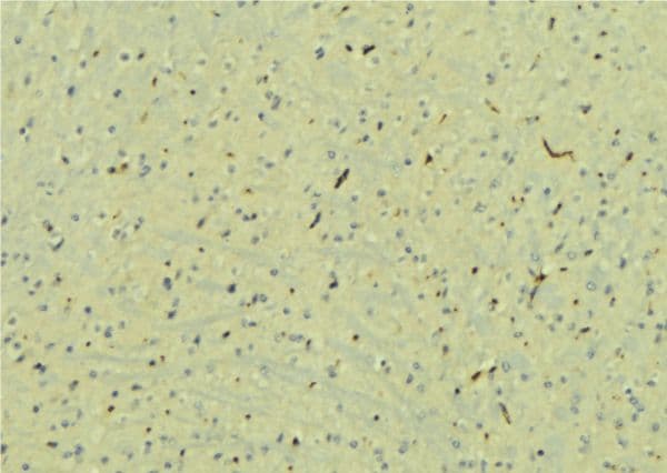 STXBP1 / MUNC18-1 Antibody