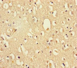 Polyclonal Rabbit anti-Human DHX35 Antibody