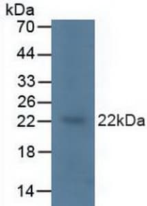 KRAS Antibody (aa1-189)