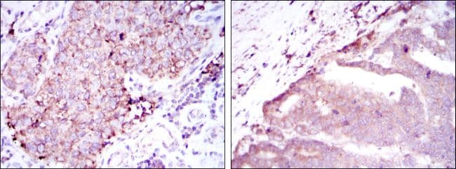 Monoclonal Mouse anti-Human BMPR2 Antibody (clone 1F12, IHC, WB)
