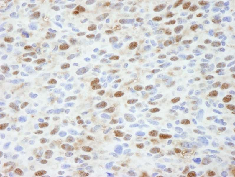 TP53BP2 / ASPP2 Antibody (aa825-875)
