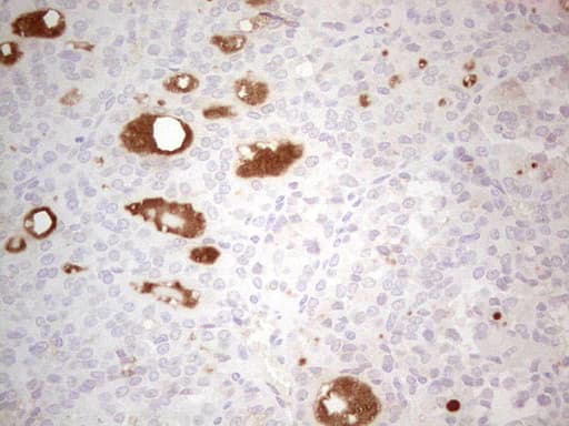 LRRC6 Antibody (clone OTI1A1)