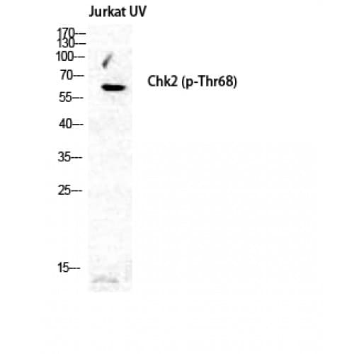 Polyclonal Rabbit anti-Human CHEK2 / CHK2 Antibody (10-90 aa, IHC, WB)