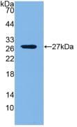 LOXL1 Antibody (aa392-598)