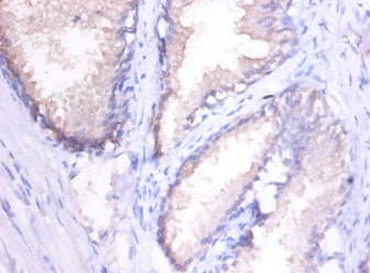 MMP1 Antibody