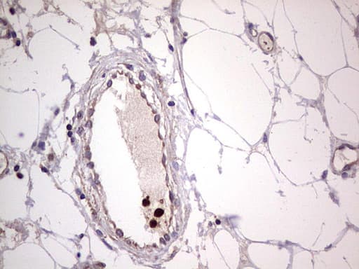 Monoclonal Mouse anti-Human PKM2 Antibody (clone 1F12, IHC, WB)