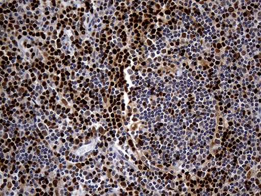 ALOX5 / 5-LOX Antibody (aa18-364, clone OTI1C1)