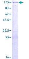 Human USP10 Protein (Recombinant GST)