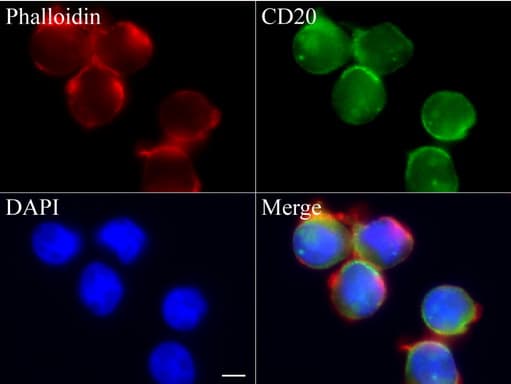 Monoclonal Mouse anti-Human CD20 Antibody (clone UMAB58, IHC, IF, WB)