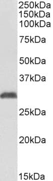 IHC-plus™ Polyclonal Goat anti-Human NAT1 / AAC1 Antibody (aa252-266, IHC, WB)