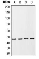 NCF1 / p47phox / p47 phox Antibody (phospho-Ser370)