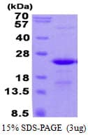 Human C17orf49 Protein (Recombinant His)