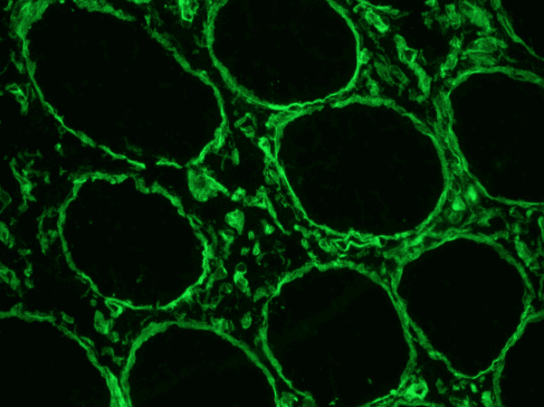 IHC-plus™ HSPG2 / Perlecan Antibody (clone A7L6)