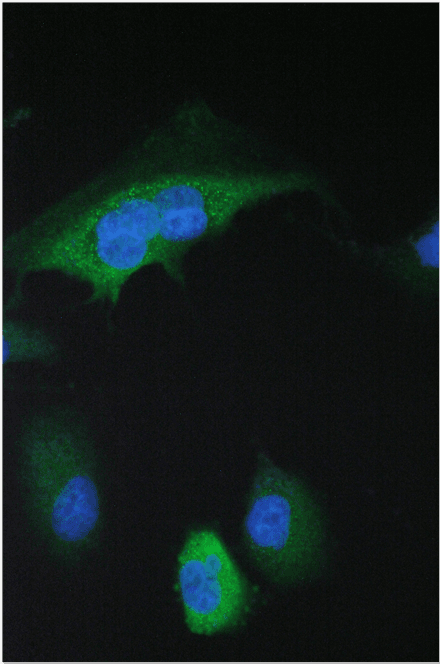 Polyclonal Rabbit anti-Human SFN / Stratifin / 14-3-3 Sigma Antibody (WB)