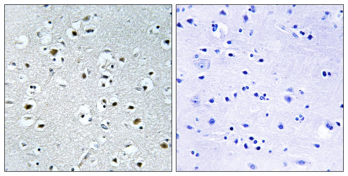 Polyclonal Rabbit anti-Human PPRC1 Antibody (IHC)