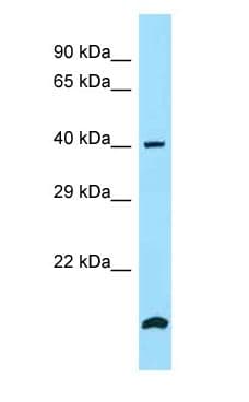 Polyclonal Rabbit anti-Human SMS / Spermine Synthase Antibody (aa77-126, WB)