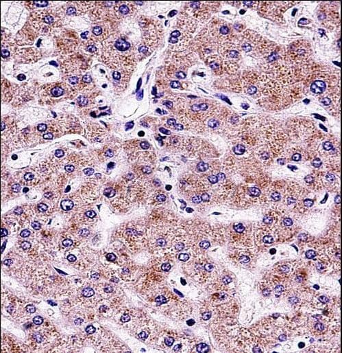 Polyclonal Rabbit anti-Human SYT6 / Synaptotagmin 6 Antibody (aa483-510, IHC, WB)