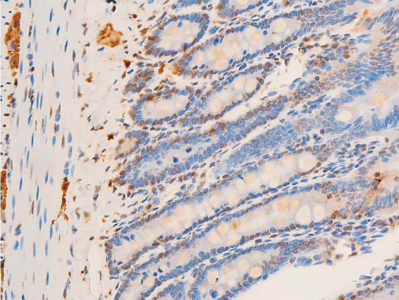 JUN / c-Jun Antibody (phospho-Thr93)