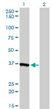 AKR1A1 Antibody (clone 1A11-2A4)