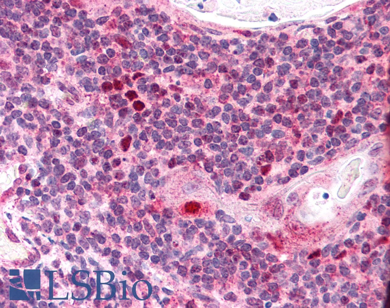 IHC-plus™ AIRE Antibody (aa534-545)